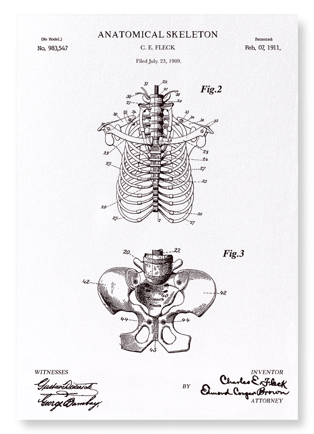PATENT OF ANATOMICAL SKELETON (1911): Patent Art Print